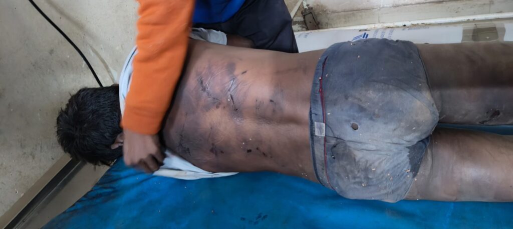 युवक का अपहरण कर ले गए,मारपीट के बाद युवक को उसके घर के दरवाजे पर छोड़ गए लेकिन इतना मारे की युवक की हो गई मौत