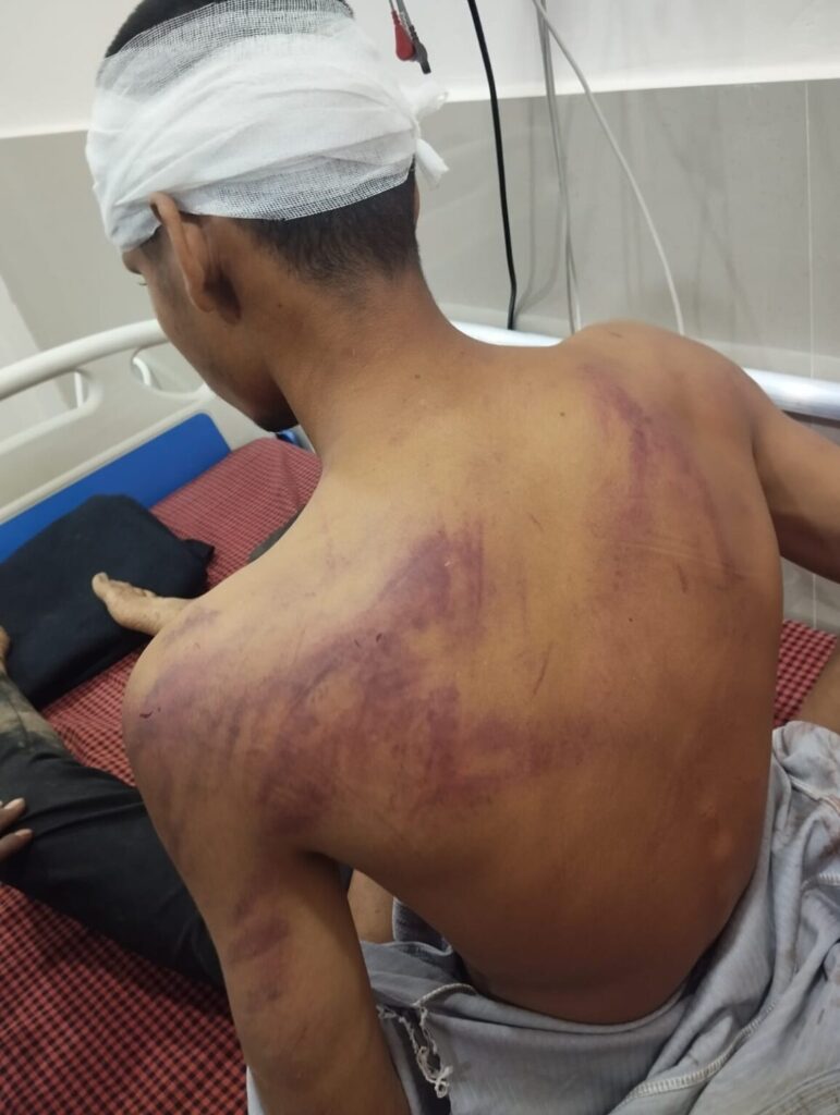 बारात में नाचने के विवाद पर बारातियों और ग्रामीणों के बीच हिंसक संघर्ष ,दे दनादन में दो युवक घायल,बारातियों के वाहनों में तोड़फोड़ भी